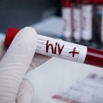 Fiji HIV Outbreak Hits Record as New Cases Surge and Treatment Gaps Grow