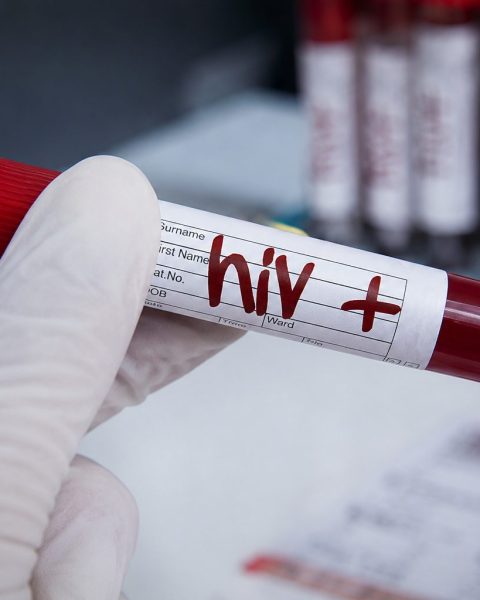 Fiji HIV Outbreak Hits Record as New Cases Surge and Treatment Gaps Grow